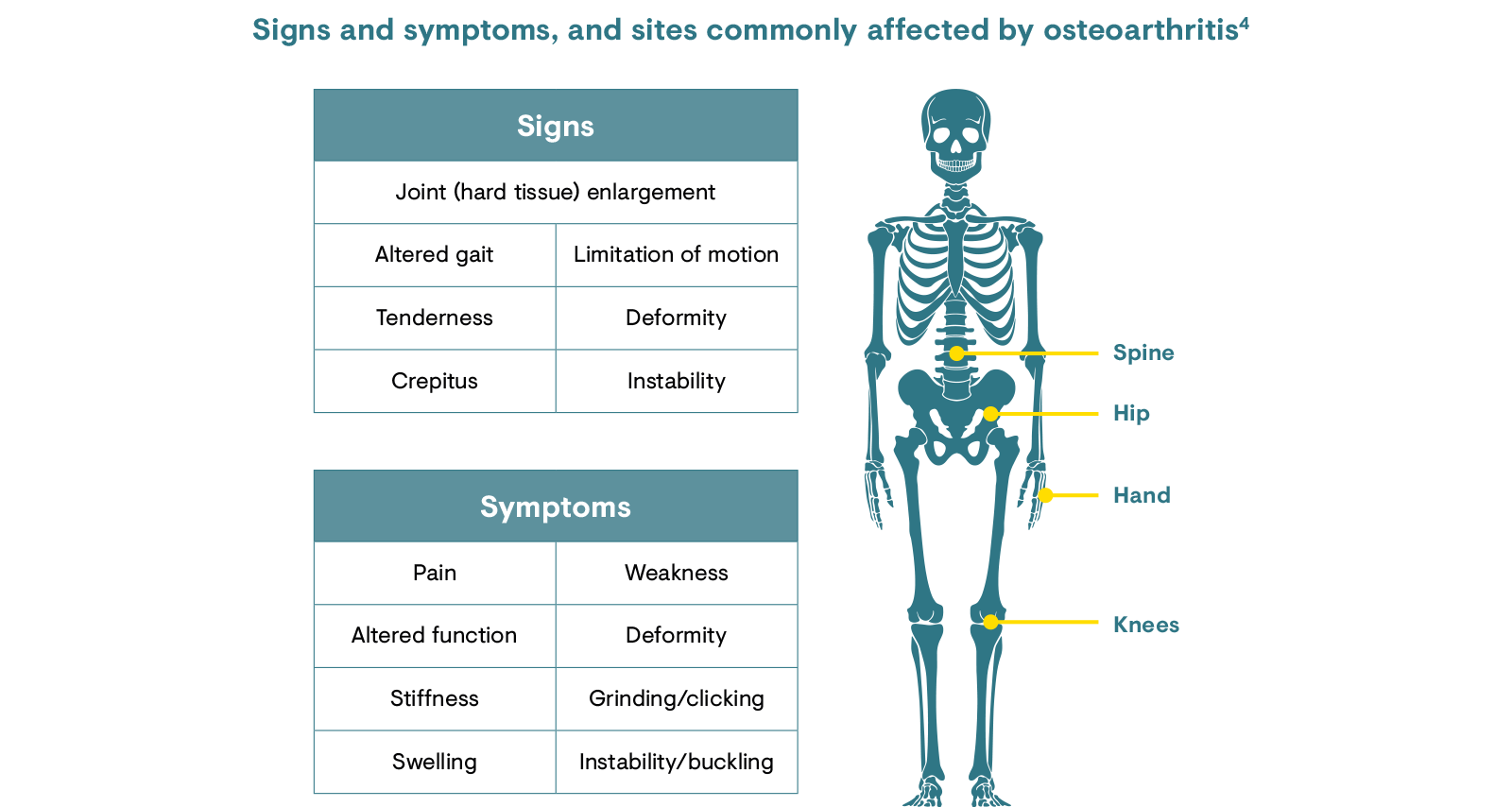 Signs and symptoms and sites commonly affected by osteoarthritis